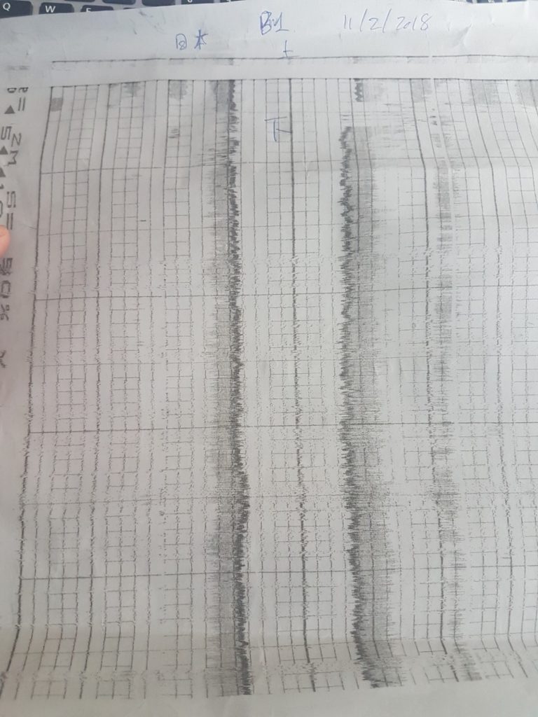 Koden Testing Graph Quy trình thi công cọc khoan nhồi và các biện pháp kiểm tra – kỹ sư ...